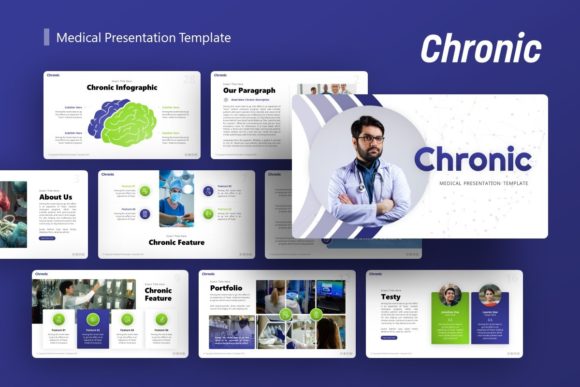 Chronic Template: Versatile Design for Modern Presentations